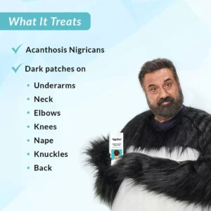 Nigrifree™ Acanthosis Nigricans Therapy Cream