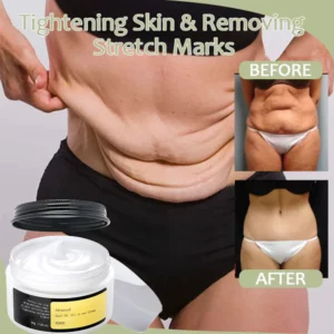 OUHOE™ Korean Snail Collagen Lifting & Firming Cream Collagen Boost Rapid Firming
