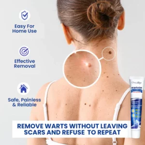 OveallgoTM WartsOff Instant Blemish Removal Cream