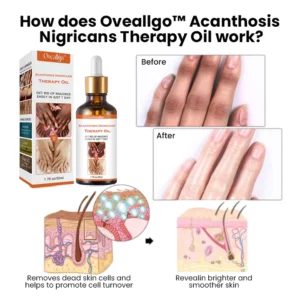 Oveallgo™ Acanthosis Nigricans Therapy Oil