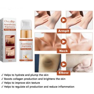Oveallgo™ Acanthosis Nigricans Therapy Spray