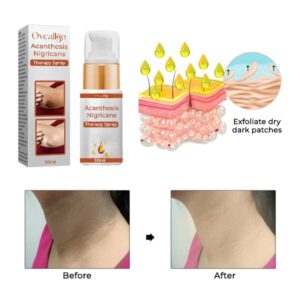 Oveallgo™ Acanthosis Nigricans Therapy Spray