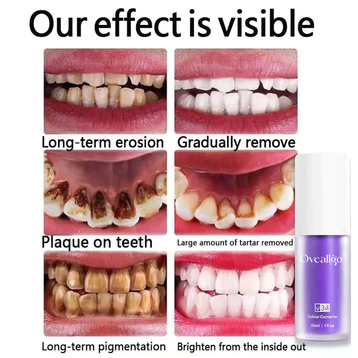 Oveallgo™ Deluxe Herbal Teeth Whitening Mousse