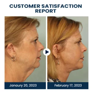 Oveallgo™ EMSPulse V-Face Sculpting Device