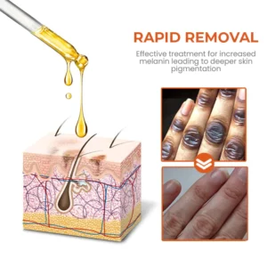 Oveallgo™ NigriClear Acanthosis Nigricans Therapy Oil