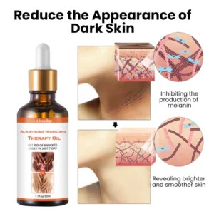 Oveallgo™ NigriClear Acanthosis Nigricans Therapy Oil