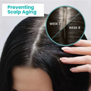 Oveallgo™ ScalpReboost PRO NMN Hair Growth Roller