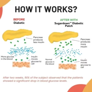 Oveallgo™ Sugardown Diabetic Patch Plus
