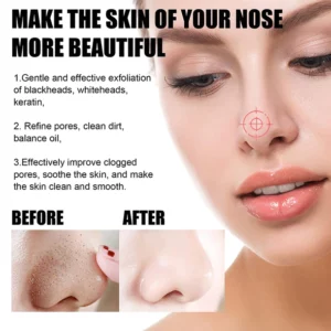 Peel-Off Facial Cleaning Non-Pore Mask