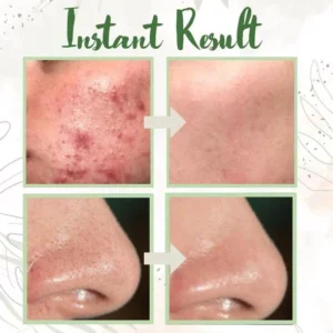 Peel-Off Facial Cleaning Non-Pore Mask