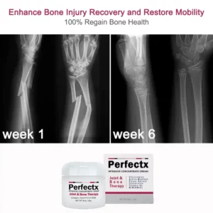 Perfeᴄtx™ Joint & Bone Therapy Cream