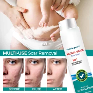 Alternative view of ProRegen™ Medical Scar Removal Spray