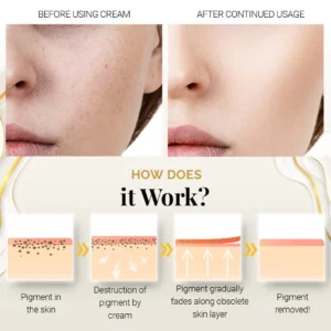 PureBright™ Korean High-Efficiency Corrective Whitening Spot Cream