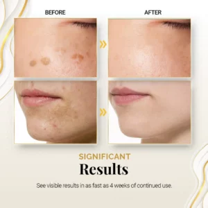 PureBright™ Korean High-Efficiency Corrective Whitening Spot Cream