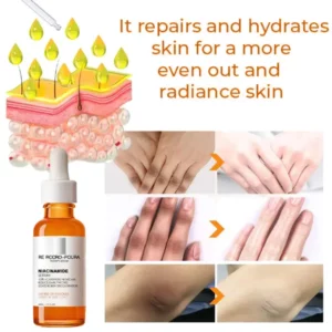 RE RCCRO-POURA™ Acanthosis Nigricans Therapy Serum