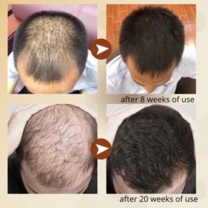 Regrowth™ Nourishing Ginger Spray
