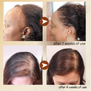 Regrowth™ Nourishing Ginger Spray