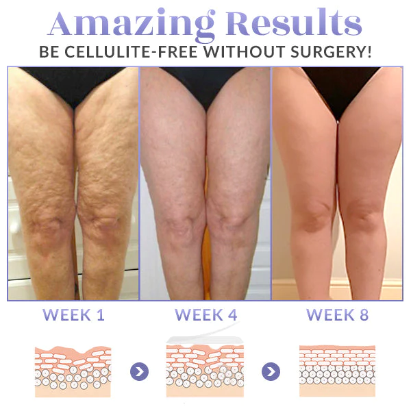 SKINNIER Tightening & Cellulite-Reducing Thigh Patch - Image 3