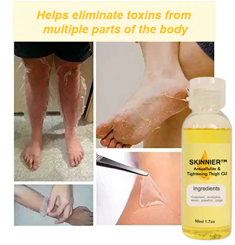 SKINNIER™ Anticellulite & Tightening Thigh Oil