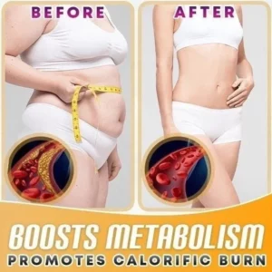 SKINNIER™ Anticellulite & Tightening Thigh Oil