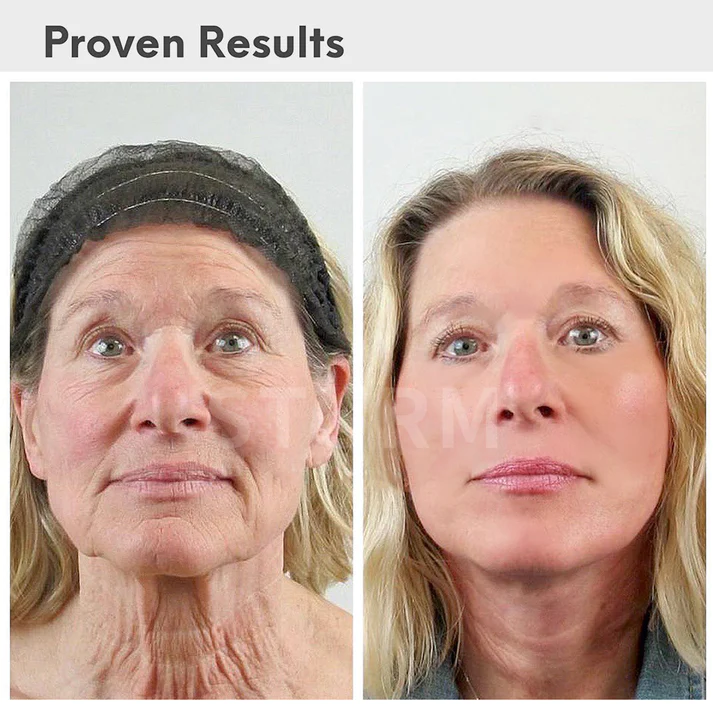 STURM® Luxury Hyaluronic Acid Anti-Aging Serum
