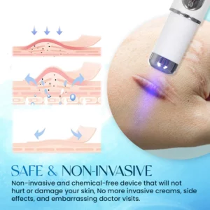 ScarErase™ UV Phototherapy Scar Removal Pen