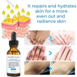 SkinRevitalx® Acanthosis Nigricans Therapy Serum