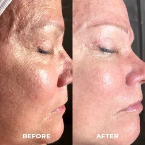 Skinetic™ Astaxanthin Egg Sleeping Mask