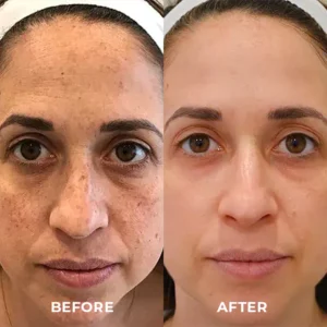 Skinetic™ Astaxanthin Egg Sleeping Mask