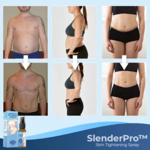 SlenderPro™ Skin Tightening Spray