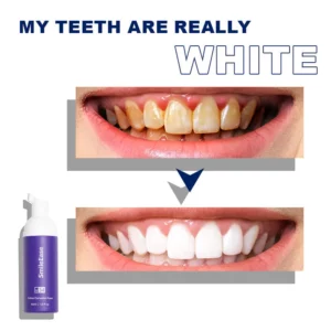 SmileEase™ Oral Care Mousse