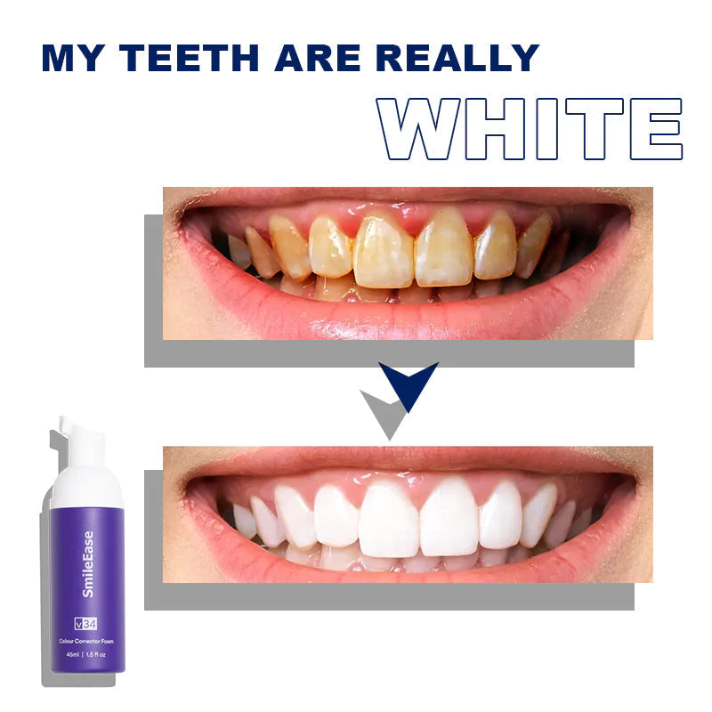 SmileEase™ Oral Care Mousse