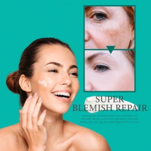 Super Blemish Revitalizing Cream