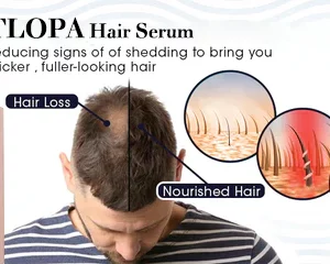 TLOPA Hair Serum