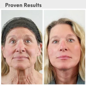 TLOPA® Luxury Hyaluronic Acid Anti-Aging Serum