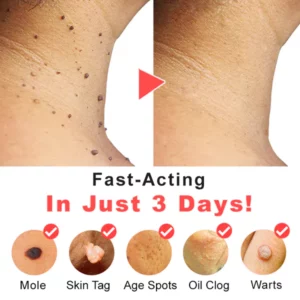 TagFix™ MicroDarts Spot Removal Patch