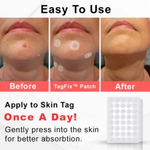 TagFix™ MicroDarts Spot Removal Patch
