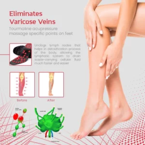 TourmaRelax™ TitanVein Far Infrared Acupressure Insoles