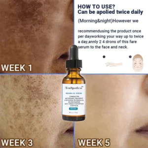 TruSpotless™ Anti-spot And Acne Elimination Serum