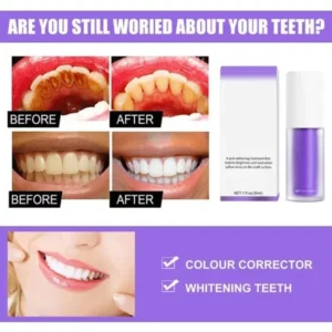 V34 Teeth Colour Corrector Serum