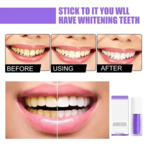 V34 Teeth Colour Corrector Serum