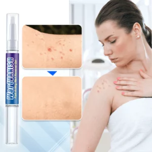 Alternative view of WartVanish™ Fast-Acting Wart Removal Gel