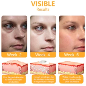 Y-EeyOil™ Firming Power