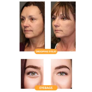 Y-EeyOil™ Firming Power