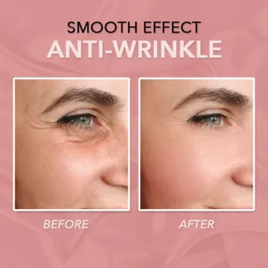 YNGKEY™ Wrinkle Erasing Stick