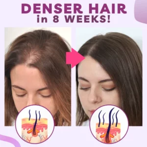 ZeroFall™ Hair Growth Minoxidil Foam