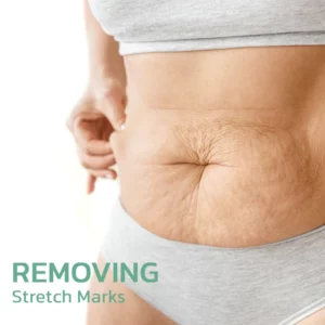 flysmus™ BeautyWomen Collagen Lifting Körperöl