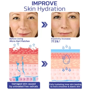flysmus™Targetline Hyaluronic Acid Micro Dart Patches