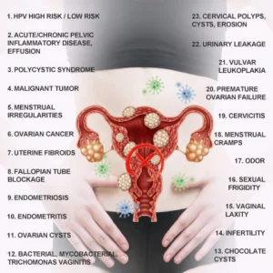 iNatureSlim® Instant Anti-Itch Detox Slimming Products