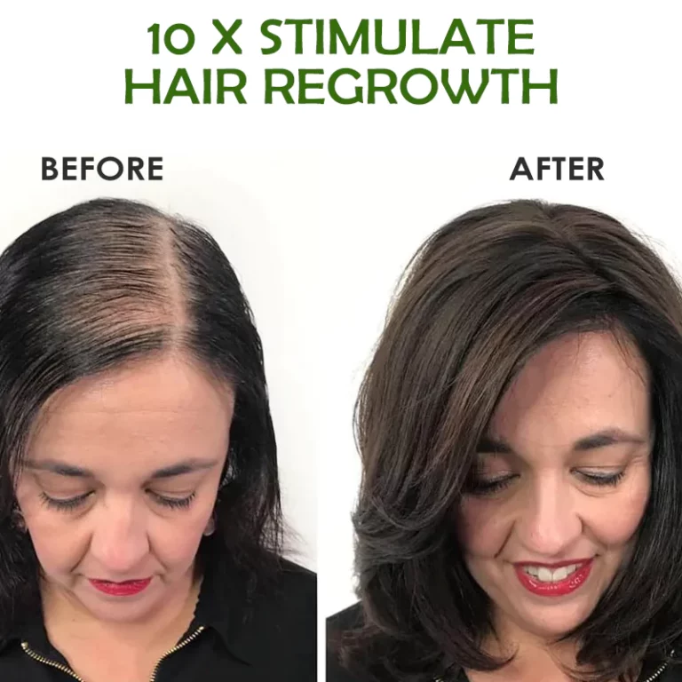 ATTDX AdvancePro Hairregrowth अर्गानिक स्प्रे